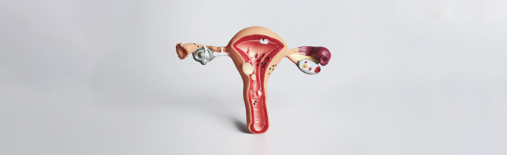 Female reproductive anatomy model for reproductive surgery information, Dr Kate Burston Newcastle gynaecologist and fertility specialist