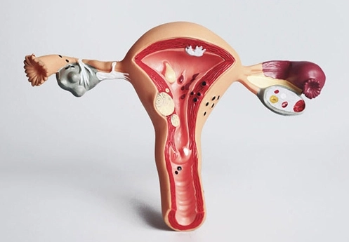 Female reproductive system model for infertility and surgery at Dr Kate Burston Newcastle clinic