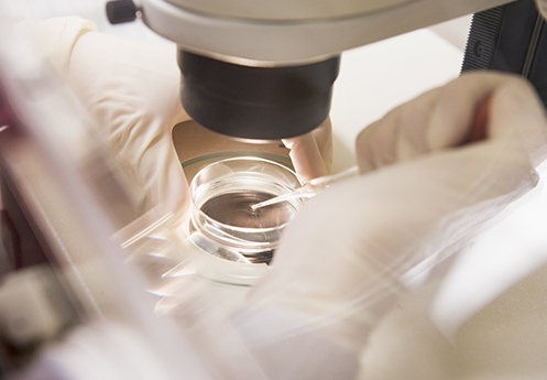 IVF treatment laboratory procedure at Dr Kate Burston Newcastle