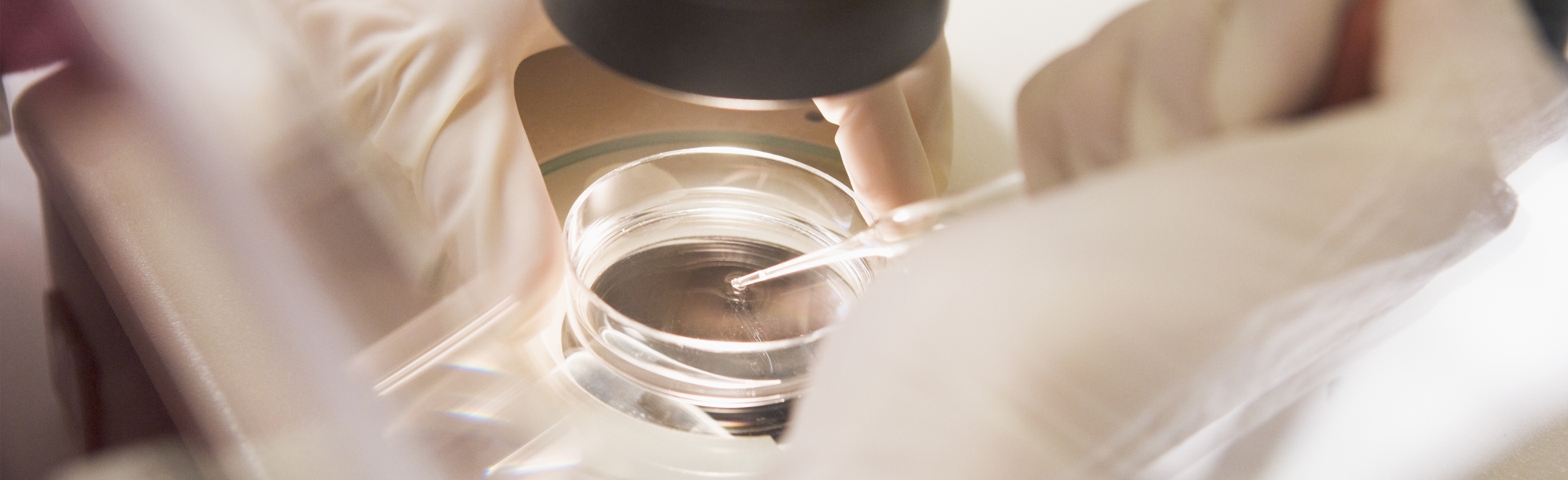 IVF embryo fertilisation process under microscope at Newcastle fertility clinic